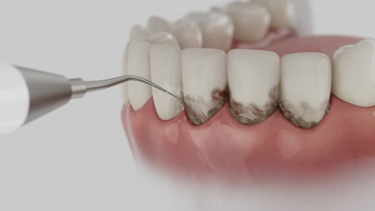 Trusted Dental Implants service in Paducah, TX - Dentist Open Now